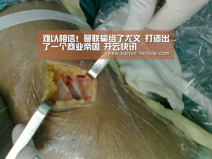 难以相信!曼联输给了尤文 打造出了一个商业帝国_开云快讯(图2) 开云比分